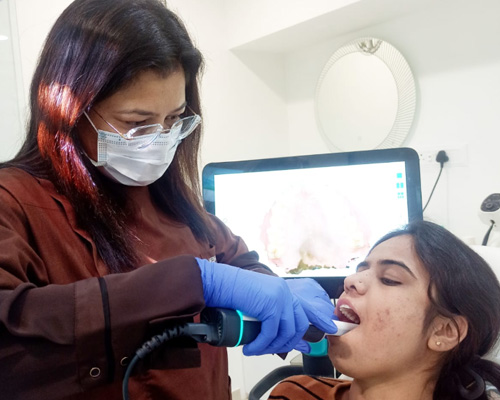 Invisalign Aligner